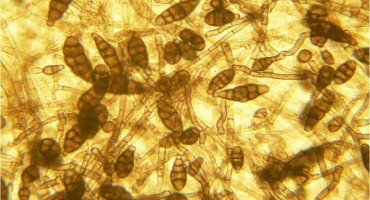 Popis alternaria brambor, léčba a hlavní opatření k boji proti této chorobě